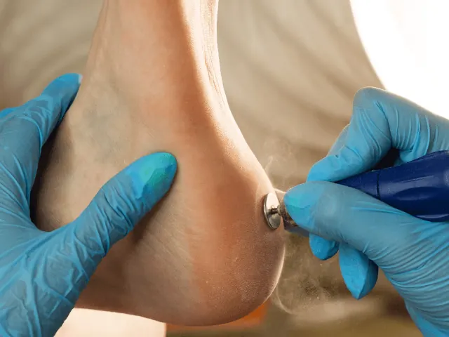 pedicure verhelpt ook voetproblemen